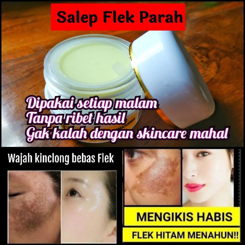 HTK/CREAM FLEK BERAT/CREAM FLEK SUPER GLOWING CREAM FLEK GLOW WHITE RACIKAN DOKTER