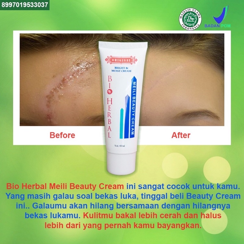 Bio Herbal Meili Cream Penghilang Bekas Luka/ Meili Beauty Cream