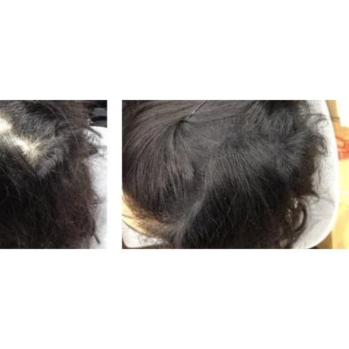 ❋ OCARE HAIR BUILDING FIBER REFILL 57g HITAM / RAMBUT ANTI BOTAK - Black, 25g ♥