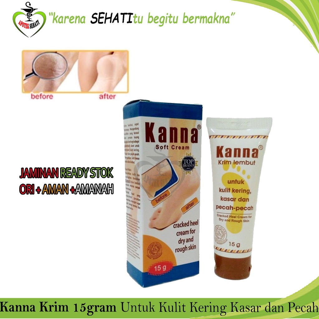 KANNA Soft Cream dan White Cream untuk Pelembab Kaki Pecah-Pecah Kanna Krim Kaki