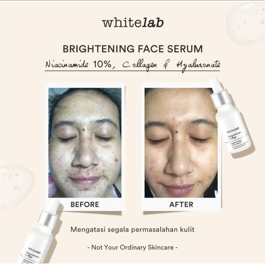 Whitelab N10-Dose+ Brightening Serum Niacinamide 10% 20ml