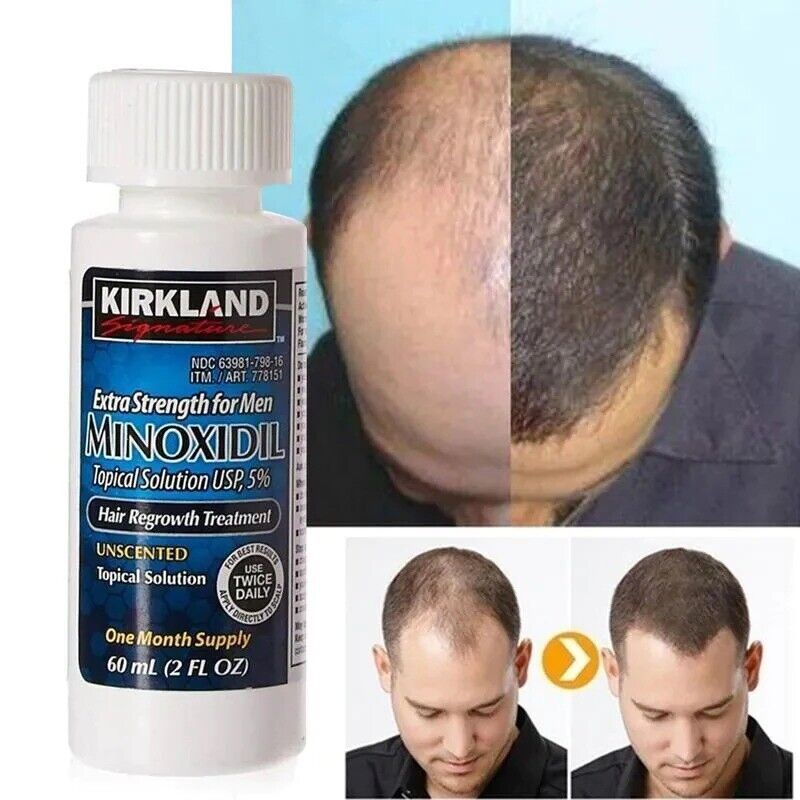 Jual Minoxidil 5 Kirkland FDA Minoxidil Original Kirkland Minoxidil