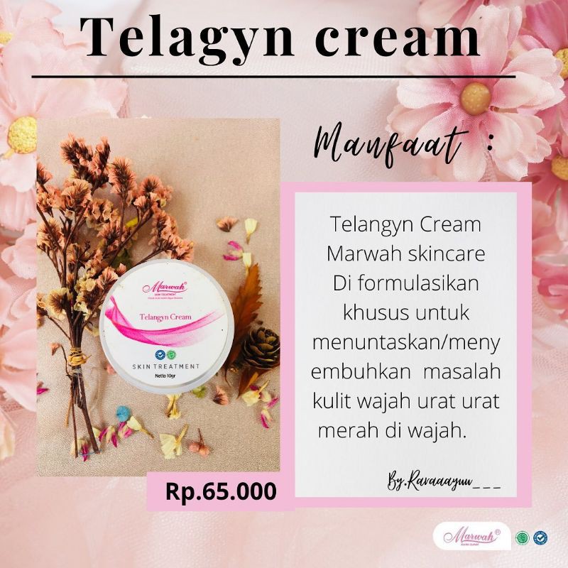 TELANGYN CREAM MARWAH SKINCARE
