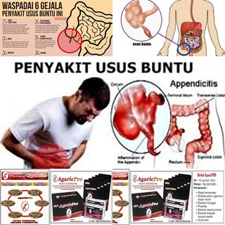 OBAT HERBAL USUS BUNTU KRONIS AMPUH TANPA OPERASI | Shopee ...