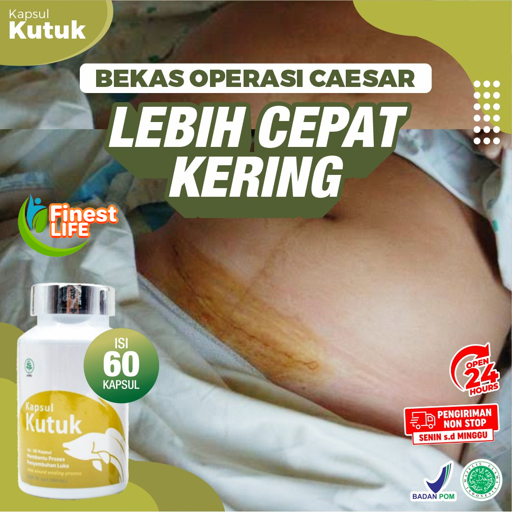 Kapsul Kutuk Premium - Original Ekstrak Albumin Ikan Gabus Obat Pasca Operasi Caesar Wasir