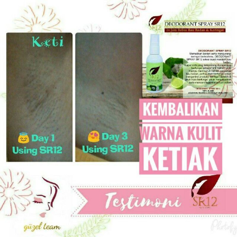 SR12 Deodorant Spray Herbal Atasi Bau Ketiak - Deo Spray Tawas Hilangkan Keringat Berlebih dan Bau Badan - Deodoran Alami Pencerah Ketiak