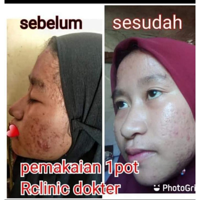 SALEP PELICIN WAJAH GLOWING (RCLINIC DOKTER)