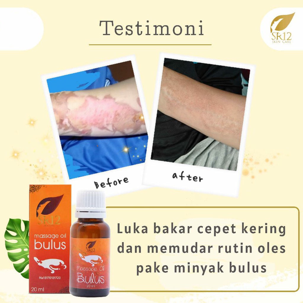 Minyak Bulus SR12 Pembesar Payudara Penghilang Strechmark Stretch Mark Massage Oil Pengencang Kulit Wajah Dan Tubuh Bulus Asli Obat Jamur Gatal BPOM Tidak Bau Amis 20ml