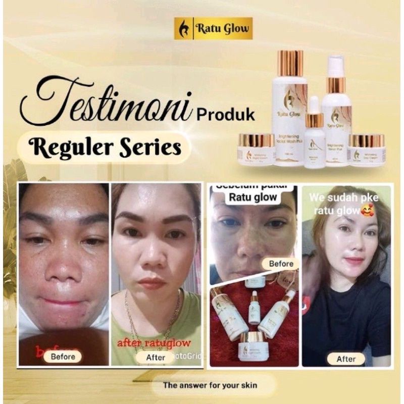 ratu glow - cream ratu glow - ratu glow cream - ratu glow skincare - skincare ratu glow - ratu glow acne - ratu glow whitening - ratu glow brightening