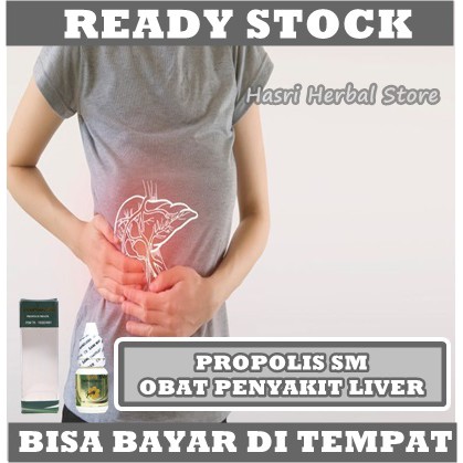 Obat Liver Perut Bengkak, Membengkak Kronis &amp; Ringan, Hepatitis A B Dan C, Penyakit Kuning, Pembengkakan Hati, Bengkak Hati, Limpa Herbal Untuk Anak Dewasa - Propolis SM Original 100% Multikhasiat Halal BPOM