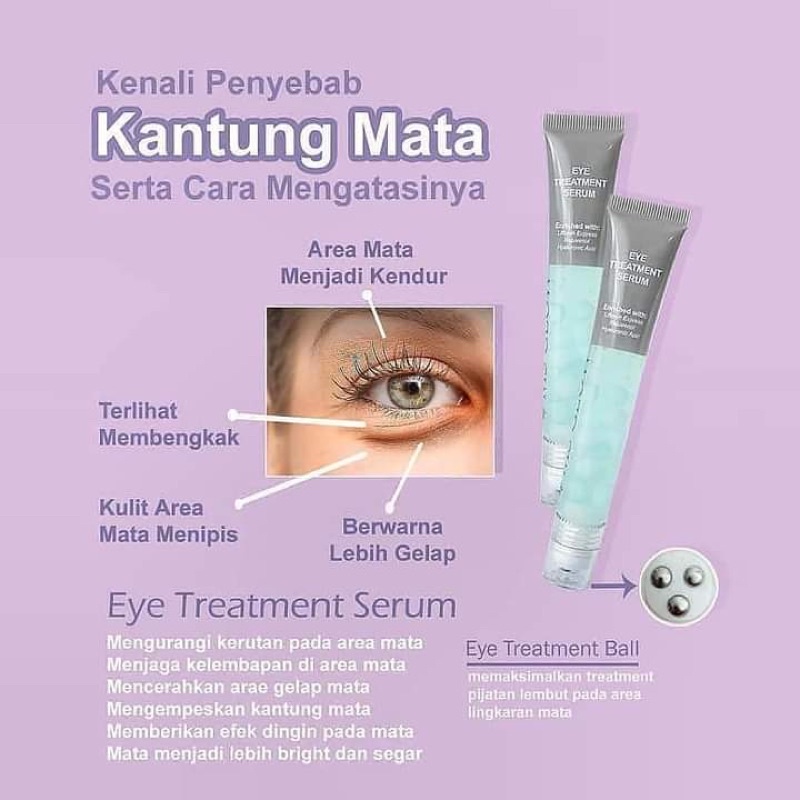 100% Original Eyes Treatment Serum MS GLOW