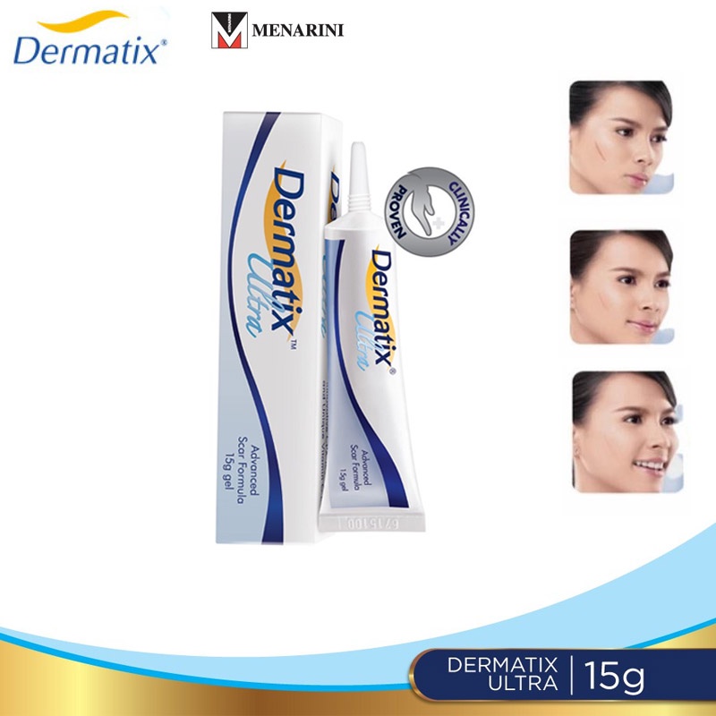 [ Original Import ] Dermatix Ultra Advanced Scar Formula Gel Cream Salep Penghilang Bekas Luka / Keloid ANTI SCAR Cream Krim Digigit Serangga Nyamuk Luka Bakar Stretchmark Stretch Mark 15gr Operasi Oprasi Iris Tergores Jerawat Gatal Hitam Ampuh