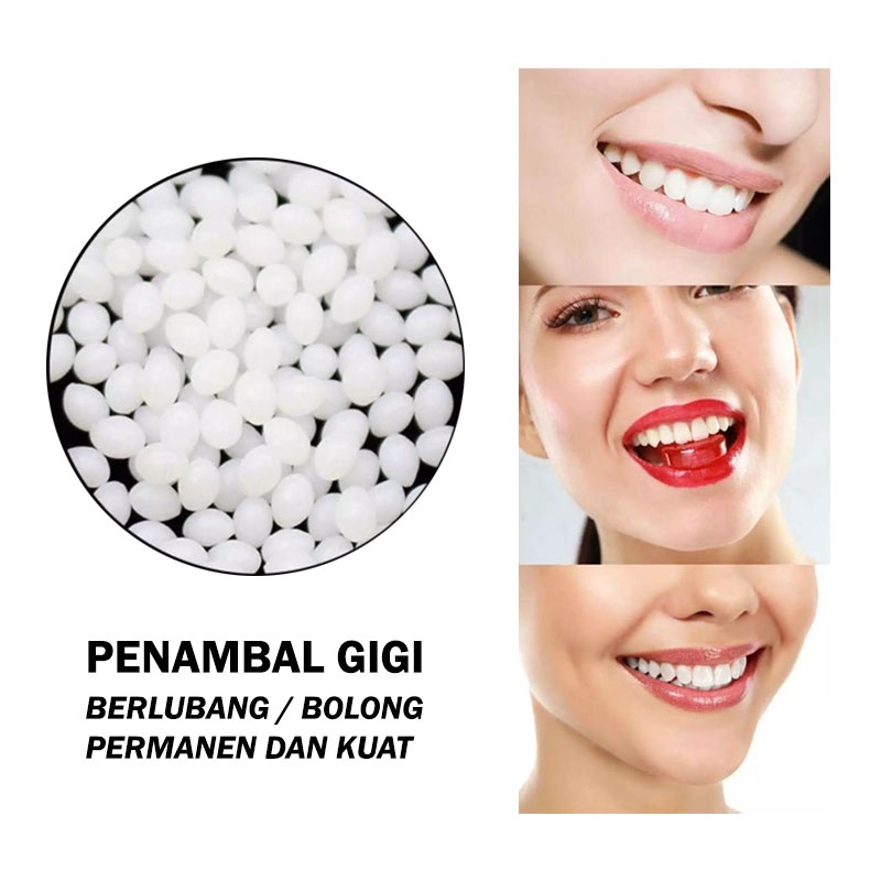 DBEST - [PAKET 50 BUTIR] Gigi Palsu / Temptooth Lem Tambal Gigi Ompong Patah dan Berlubang / Temporary Tooth