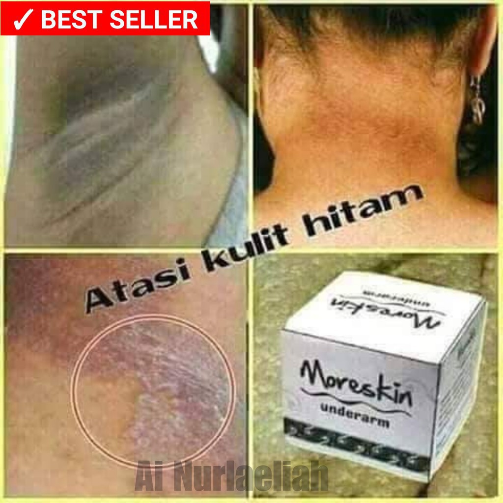 

Moreskin Underarm pemutih ketiak bekas luka dll Herbal alami nasa ori