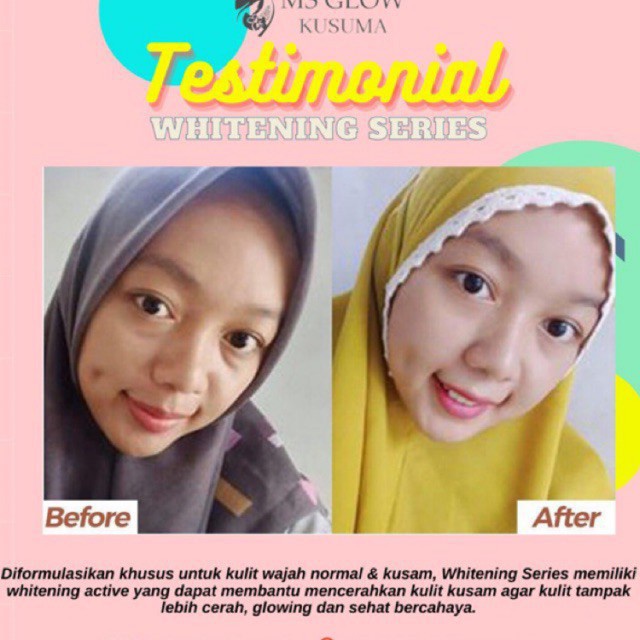 MS Glow Paket Wajah Whitening Acne Ultimate Luminous Komplit Dengan Facial Wash Toner Day Cream BB Cream Night Cream Serum Whitening Gold Lifting Acne Luminous Peeling Cell DNA Red Jelly Deep Essence Yuzu Cactus Watermelon Moisturizing