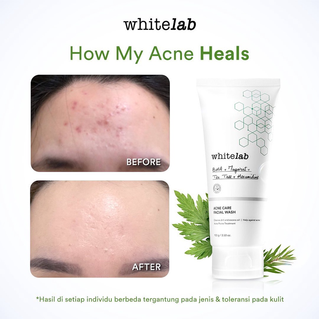 Whitelab Brightening Facial Wash | pH-Balanced Facial Cleanser | Acne Care Facial Wash