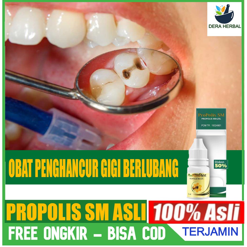 Obat Untuk Gusi Bengkak Gigi Berlubang Obat Sariawan Propolis Sm Herbal Original Asli Shopee Indonesia