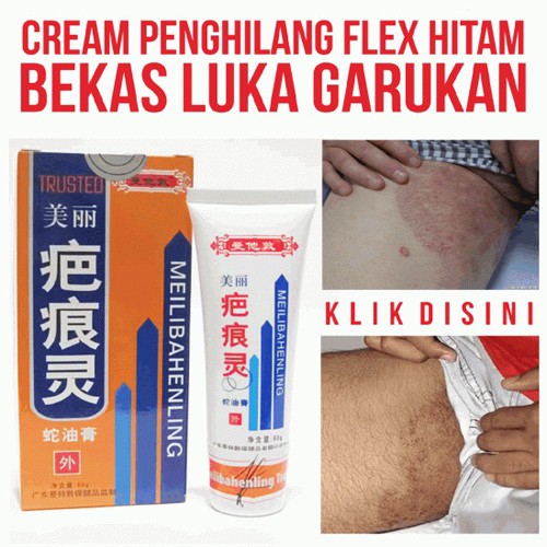 Cream untuk menghilangkan noda hitam bekas cacar