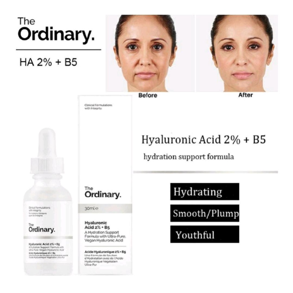 The Ordinary Hyaluronic 2% B5 Serum Wajah