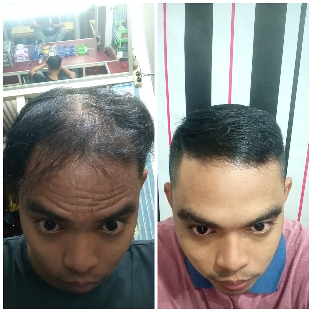 Selalu Lebat - Paket Rambut Gondrong dan Lebat