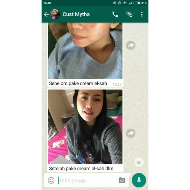 EL-SHA Paket FLEK & JERAWAT GLOWING-Tanpa Pengelupasan Memutihkan dan Mencerahkan Kulit Wajah