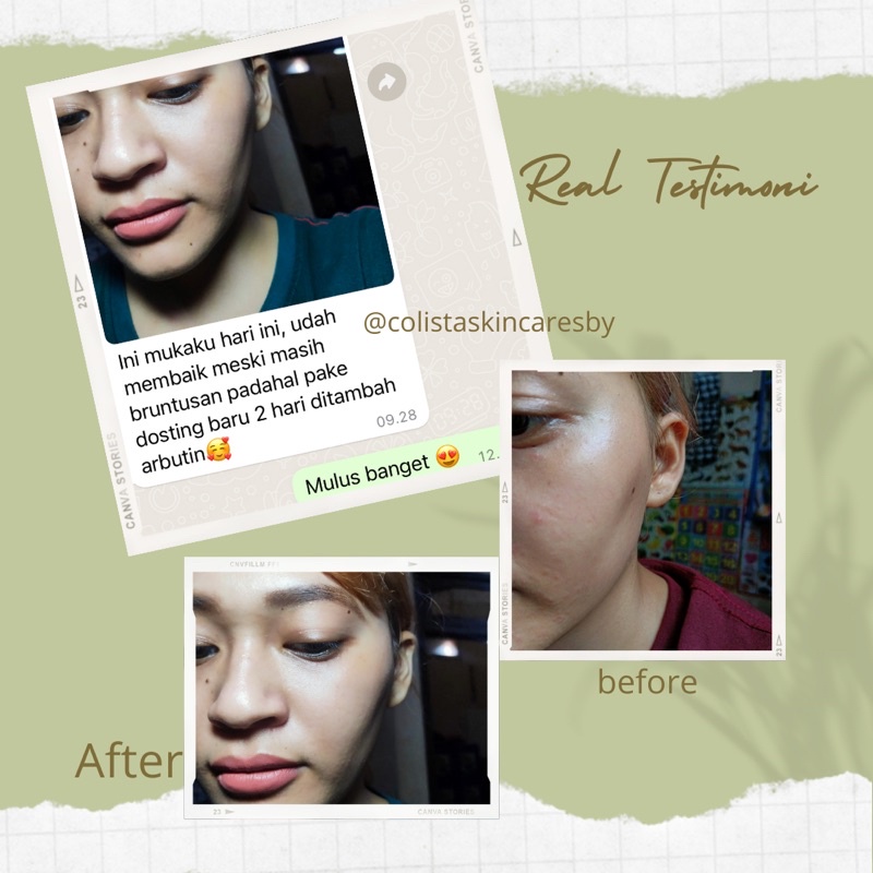 Paket Normal Dosting Colista skin care-2