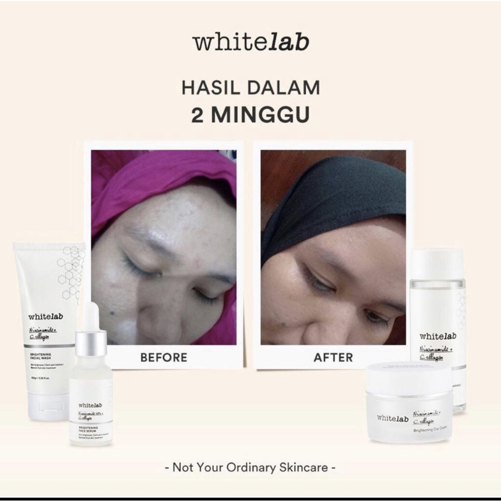 Whitelab Brightening Paket Wajah &amp; Serum | Facial Wash + Toner + Day Cream + Nite Cream + Brightening Serum