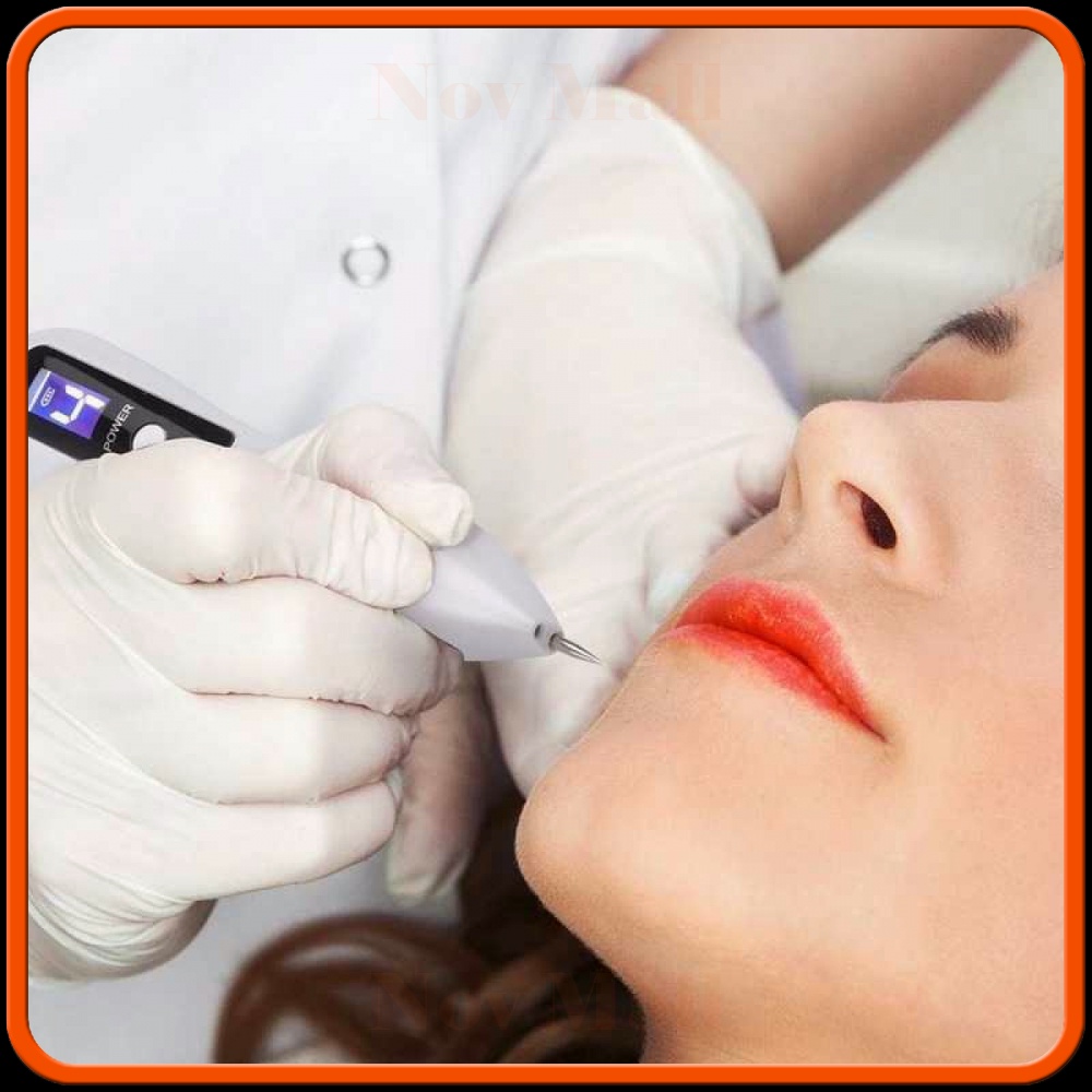 Pen Laser Plasma Penghilang Jerawat Dark Spot Wajah - BY287