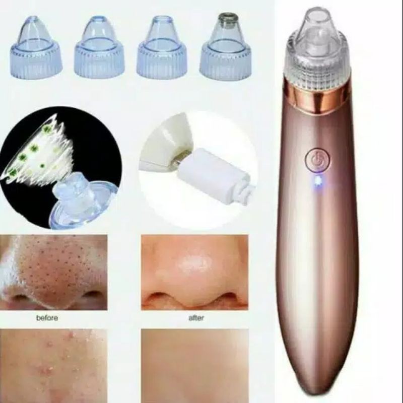 Sedot komedo - Blackheads remover cleanser vacuum XN8030-vakum komedo