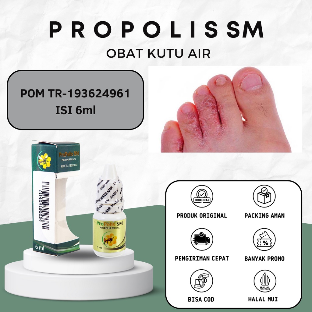 Propolis SM Obat Kutu Air Tangan dan Kutu Air Kaki