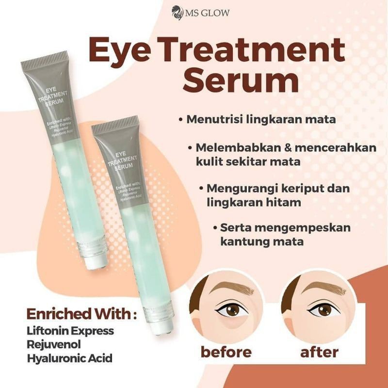 Eye Treatment Serum MS Glow Serum mata original perawatan mata