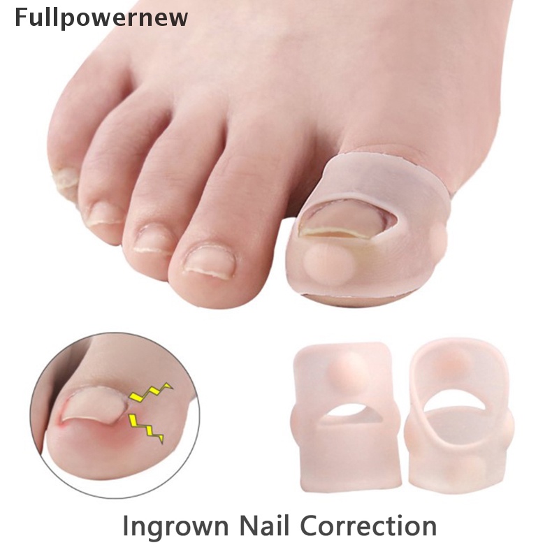 [FULL] 1Pair Silicone Ingrown Toenail Correction Tool Invisible Toe Nail Treatment