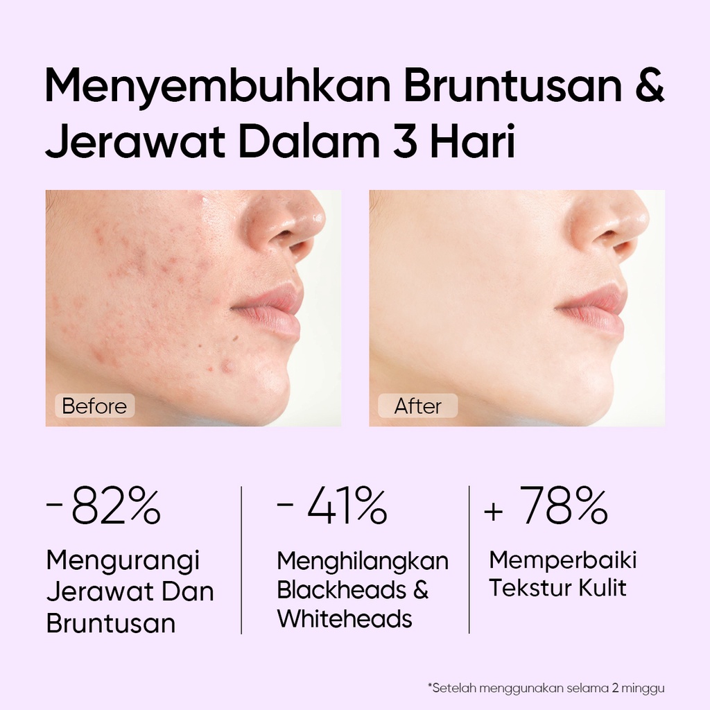 SKINTIFIC - 5% Aha Bha Pha Exfoliating Toner BPOM Original READY STOCK