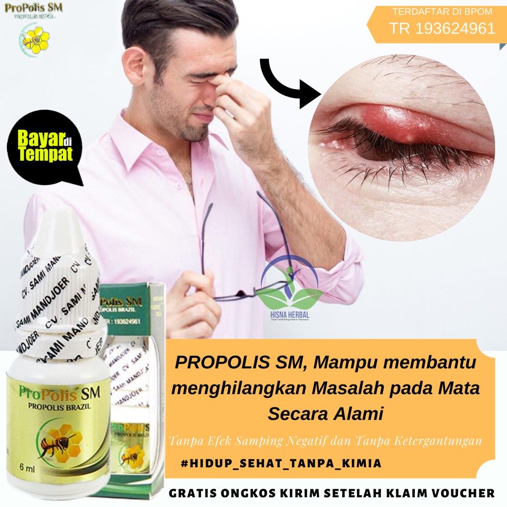 Jual Obat Untuk Bintitan Yang Sudah Mengeras, Menahun, bertahun-tahun