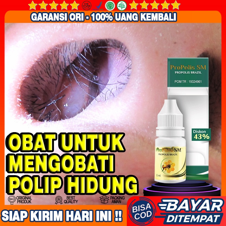 Obat Polip, Obat Sinusitis Menahun, Obat Sinusitis Kronis Akut, Obat Sinusitis Hidung Polip, Obat Pi