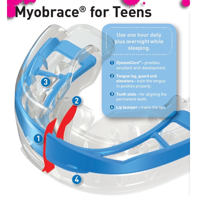 MYOBRACE for TEENS 10-15TH/ MYOFUCTIONAL ORTHODONTICS/ TRAINER GIGI ANAK ORIGINAL/ TRAINER ALIGNMENT