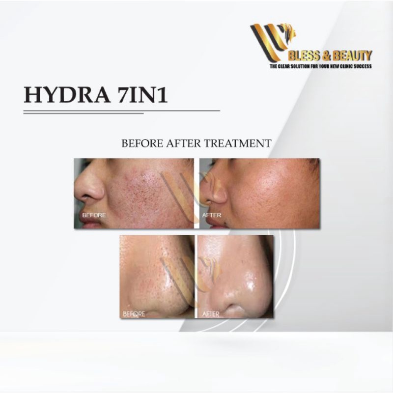 Mesin RF Hydra dermabrasion 7in1 Radio frekuensi vacum dermabrasio