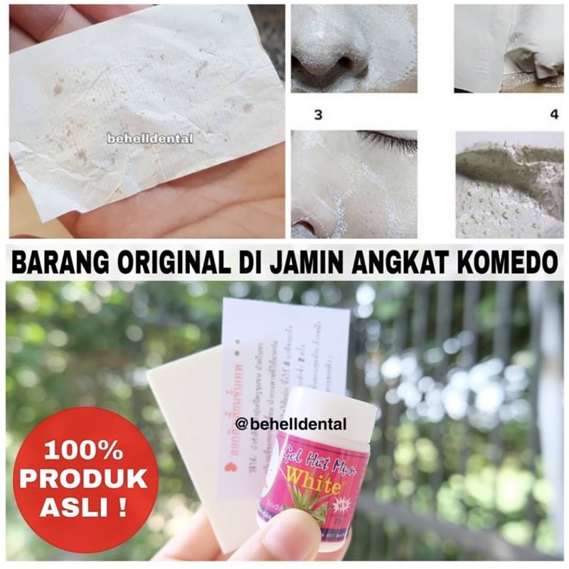 TERAMPUH GEL MAT NA HUT MUN WHITE . GELMATNA HUTMUN . ALAT PENGHILANG PENCABUT KOMEDO BEHELLDENTAL