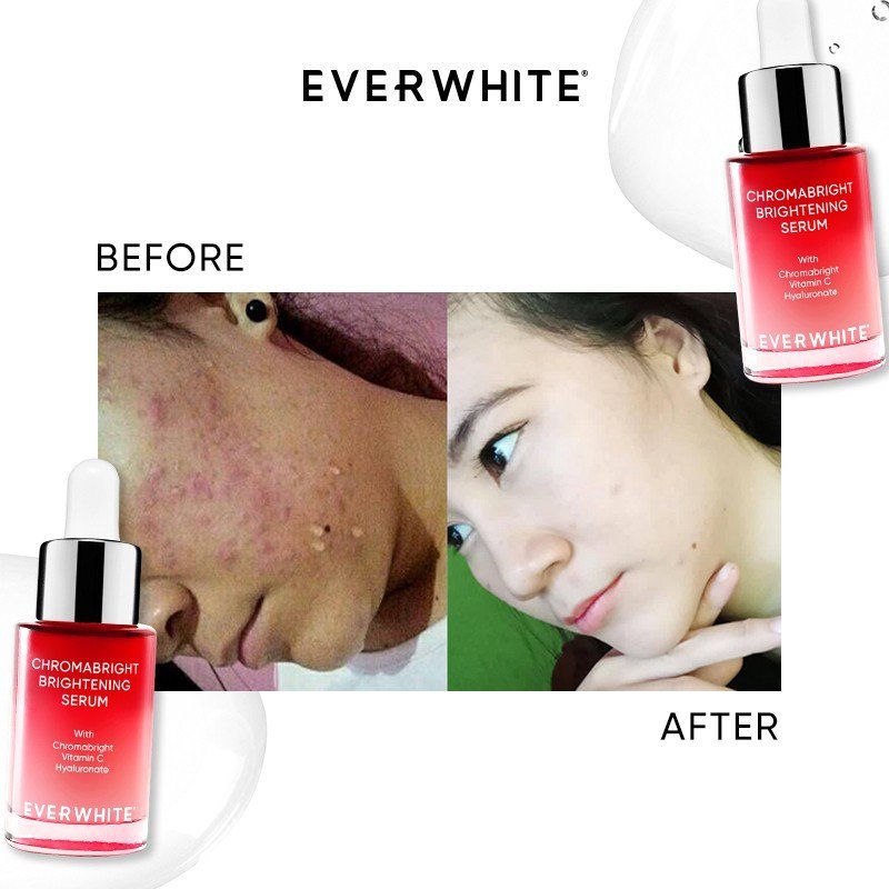 Everwhite Brightening Serum Cica/Niacinamide/Chromabright