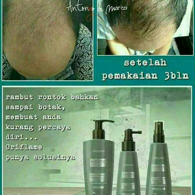 HAIR X NEOFORCE SET / PERAWATAN RAMBUT RONTOK Import swedia