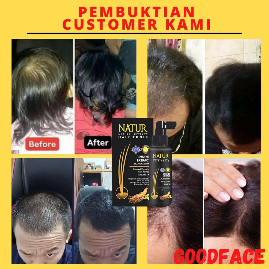 NATUR HAIR TONIC GINSENG EXTRACT ORIGINAL BPOM 90ML TONIC RAMBUT RONTOK PERAWATAN RAMBUT RONTOK ANTI RONTOK TREATMENT RAMBUT