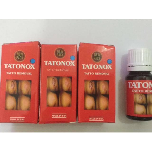 Tatonox penghilang tato