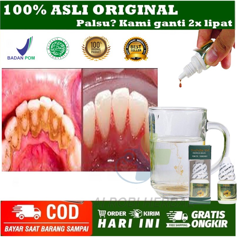 Obat Karang Gigi Rontok Dan Bau Mulut Pemutih Bau Mulut Propolis Sm 100 Asli Original Bpom Cod Shopee Indonesia