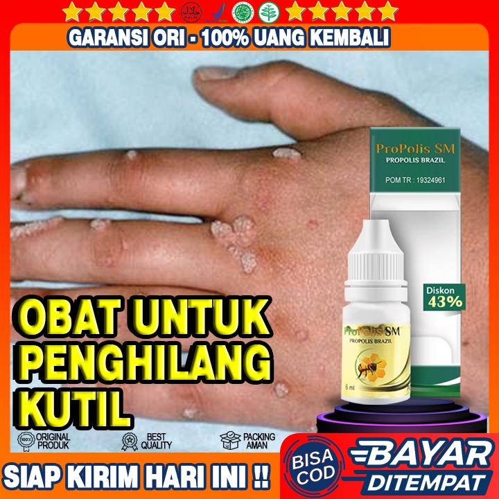 Obat Kutil, Obat kutil kelamin pria, Obat kutil papiloma, Obat kutil di leher, kutil kelamin wanita