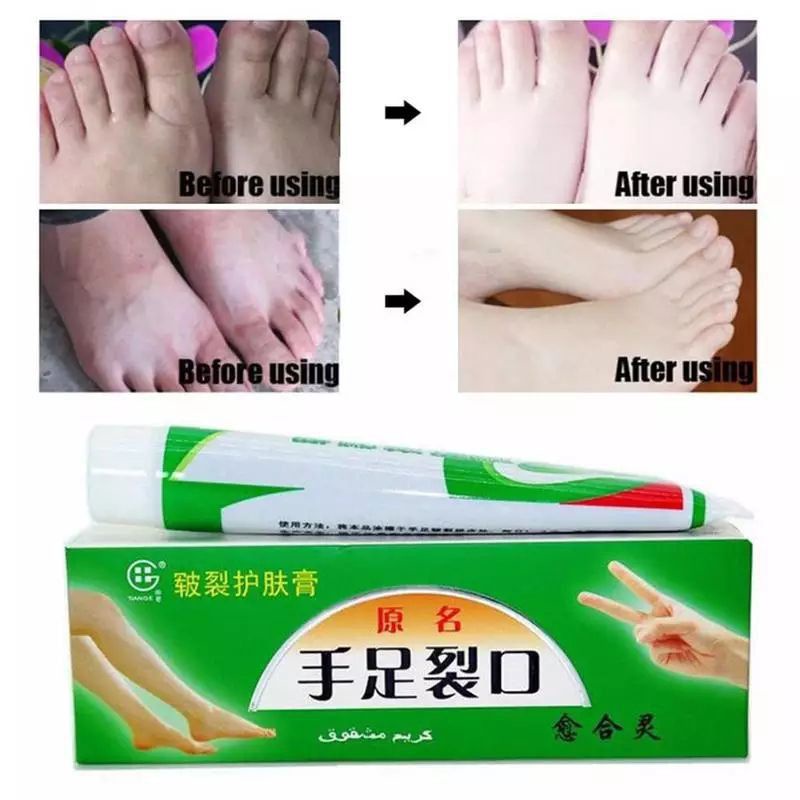 CREAM SALEP TUMIT KAKI PECAH KAPALAN DAN KERING RAYAPAN TANGAN SHOU ZI LIE KOU ORIGINAL TUMITKU FOOT KRIM AMPUH