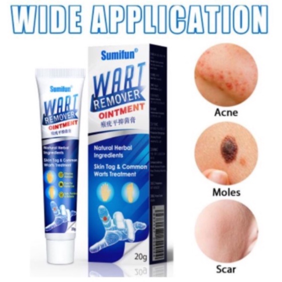 Wart Removal Cream Repair And Clean Skin Tag Remover 20g - Menghilangkan Kutil Tahi Lalat Mata Ikan Sumifun Obat Kutil