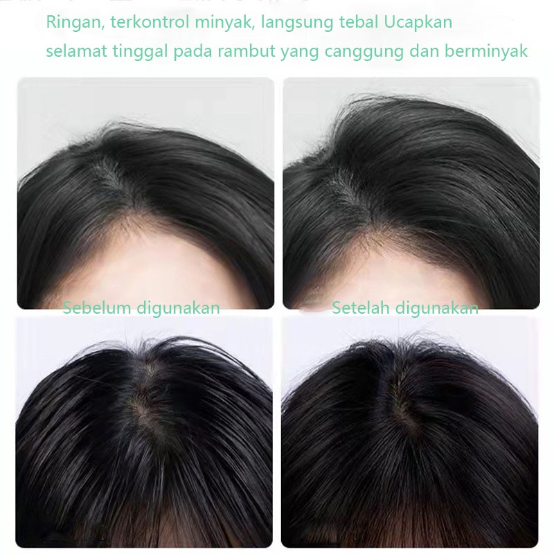 alat rambut pelembut rambut kering Semprotan Kontrol Minyak Rambut Kering 300g kontrol minyak cepat tanpa keramas  semprotkan ringan dan segarkan sepanjang hari  suatu keharusan bagi orang yang malas