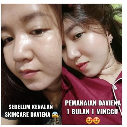 Daviena skincare medan - Glowing series Komplit / Paket Hemat Daviena Best seller-5