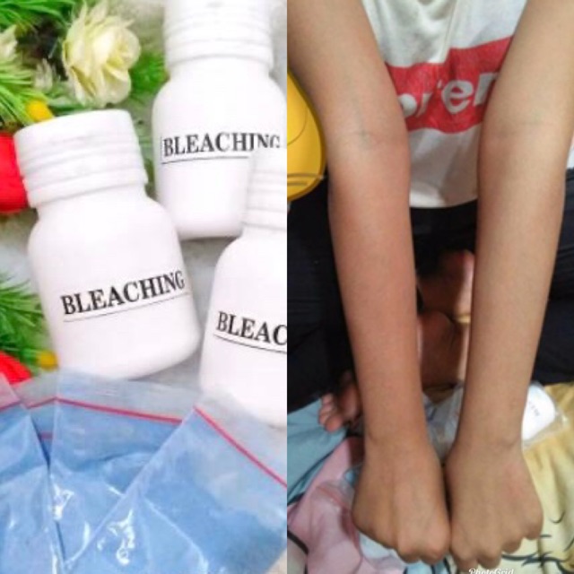 Dermovate bleaching dan handbody