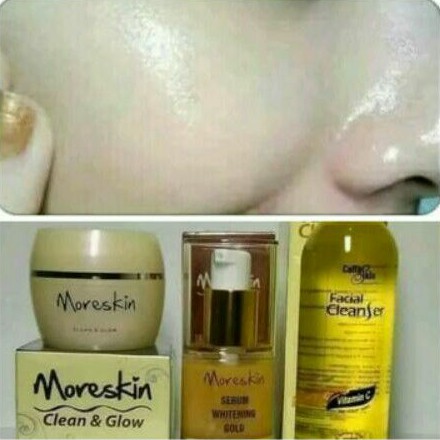 paket glowing dan flek hitam moreskin nasa